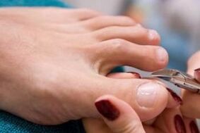 pedicure as a way of nail fungus infection