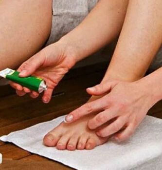 Use of therapeutic ointment to defeat the nail of the big toe from the fungus