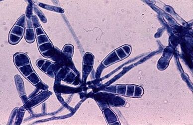 bacteria that cause nail fungus